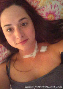 One week after surgery.